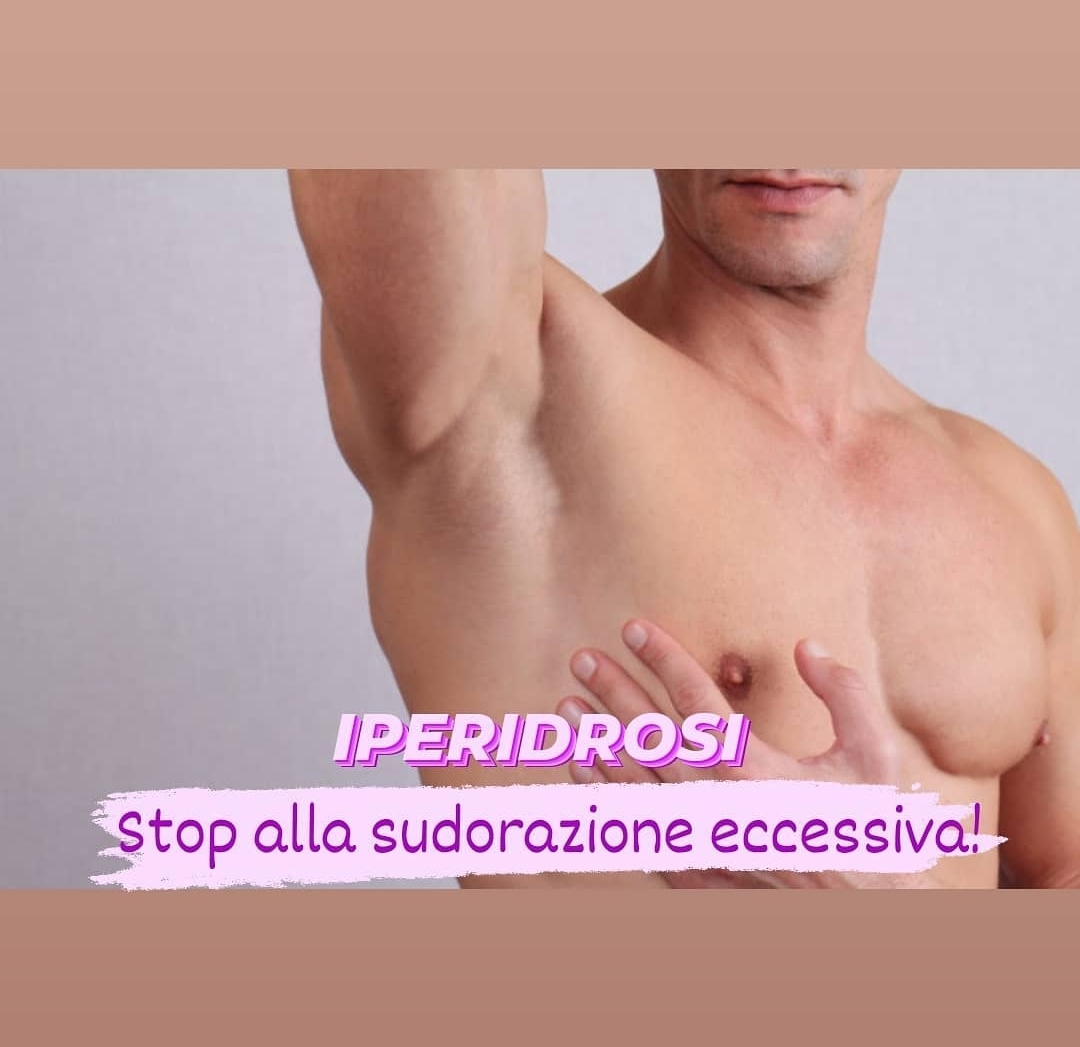 Trattamento iperidrosi